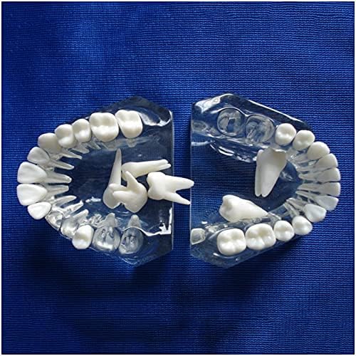 Modelo de dentes de demonstração dental kh66zky com dentes removíveis para ensinar e estudar coleção