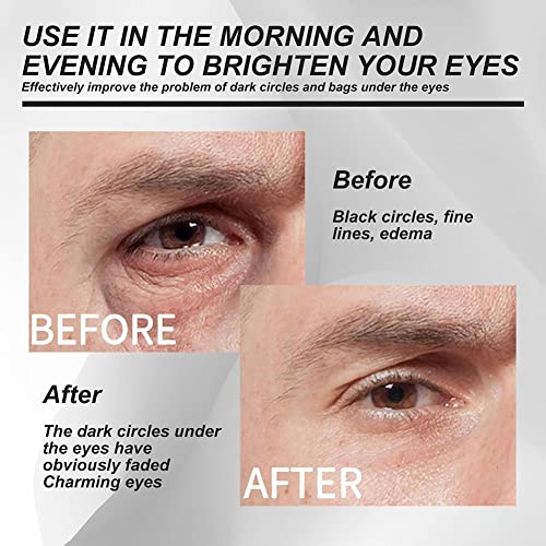 Tpalpkt Men's Eye Firming Cream Sacos de olhos Fade Remova Circulares escuras Antienvelance Hidratante nutritivo Reparando homens Creme de cuidados com a pele dos olhos