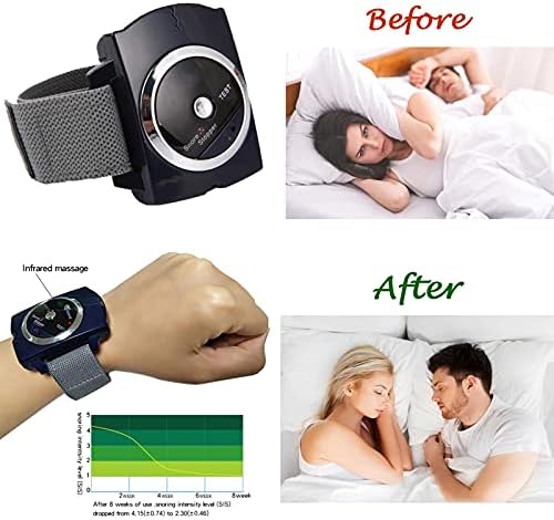 Yuerwover Infravermelho Anti -roncamento Dispositivos de pulseira Conexão de conexão de conexão de rotação de pulseira de pulseira de ronco inteligente Solução Bom Sono Sleep Aid Retener para homens e mulheres com bateria