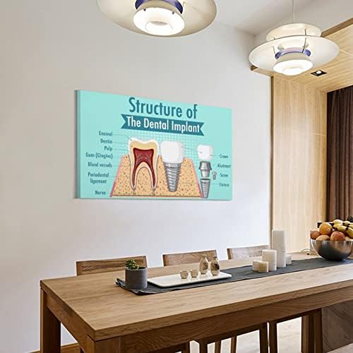 Bludug Dental Implant Dental Care Poster Dental Clinic Poster Poster Posters e Impressões de Arte da parede Pictures