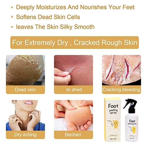 Spray de atendimento a pé Desquamação de calor de alívio do pé Spray de pé de rachadura de pele, adequado para cuidados com a pele do inverno