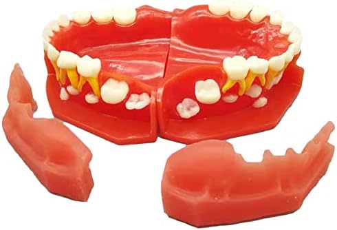 Modelo alternativo de dentes decíduos e permanentes para crianças KH66ZKY - Modelo de dentes decíduos - para ferramenta de aprendizado de ensino médico, 3 a 6 anos