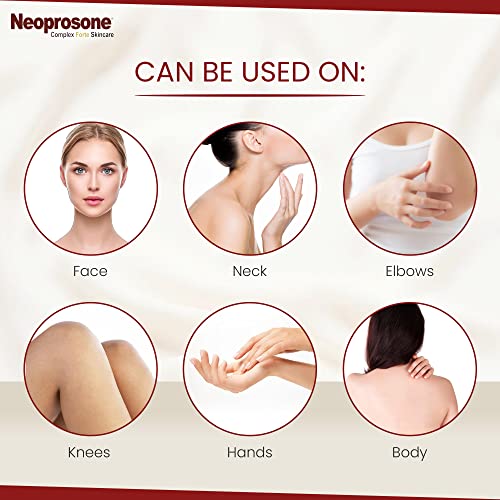 Neoprosona, creme de iluminação da pele - 3,4 fl oz / 100 ml - creme hidratante para tom de pele irregular, para o corpo do rosto, cotovelos, mãos, áreas sensíveis